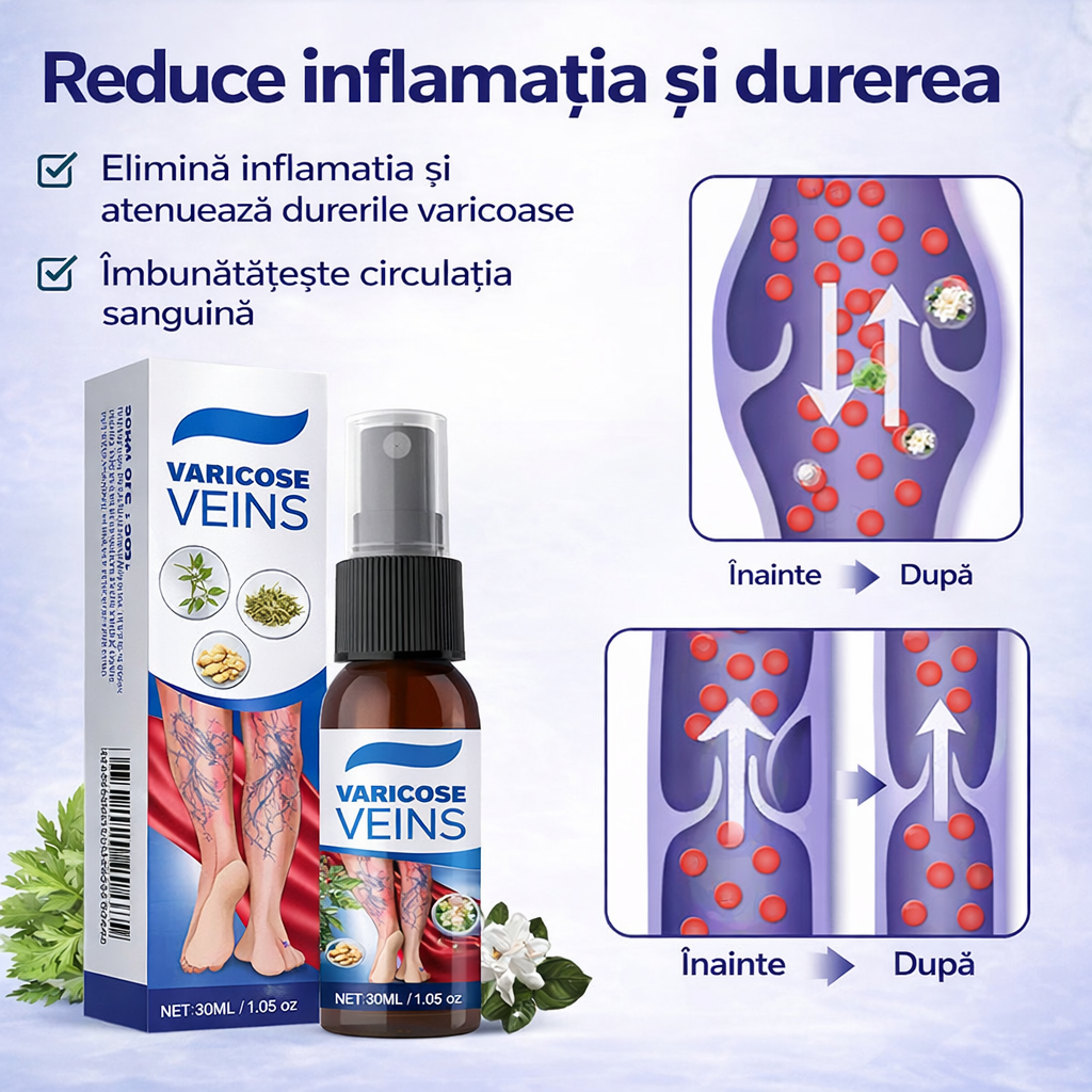 Spray Pentru Varice – Confort Și Îngrijire Pentru Picioarele Tale