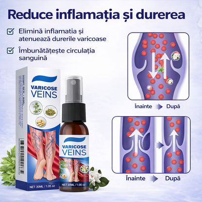 Spray Pentru Varice – Confort Și Îngrijire Pentru Picioarele Tale