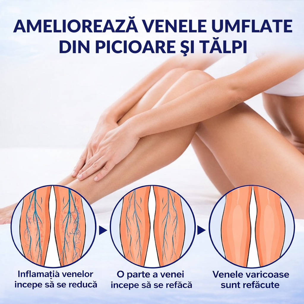 Spray Pentru Varice – Confort Și Îngrijire Pentru Picioarele Tale